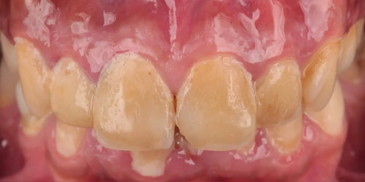 Before Image