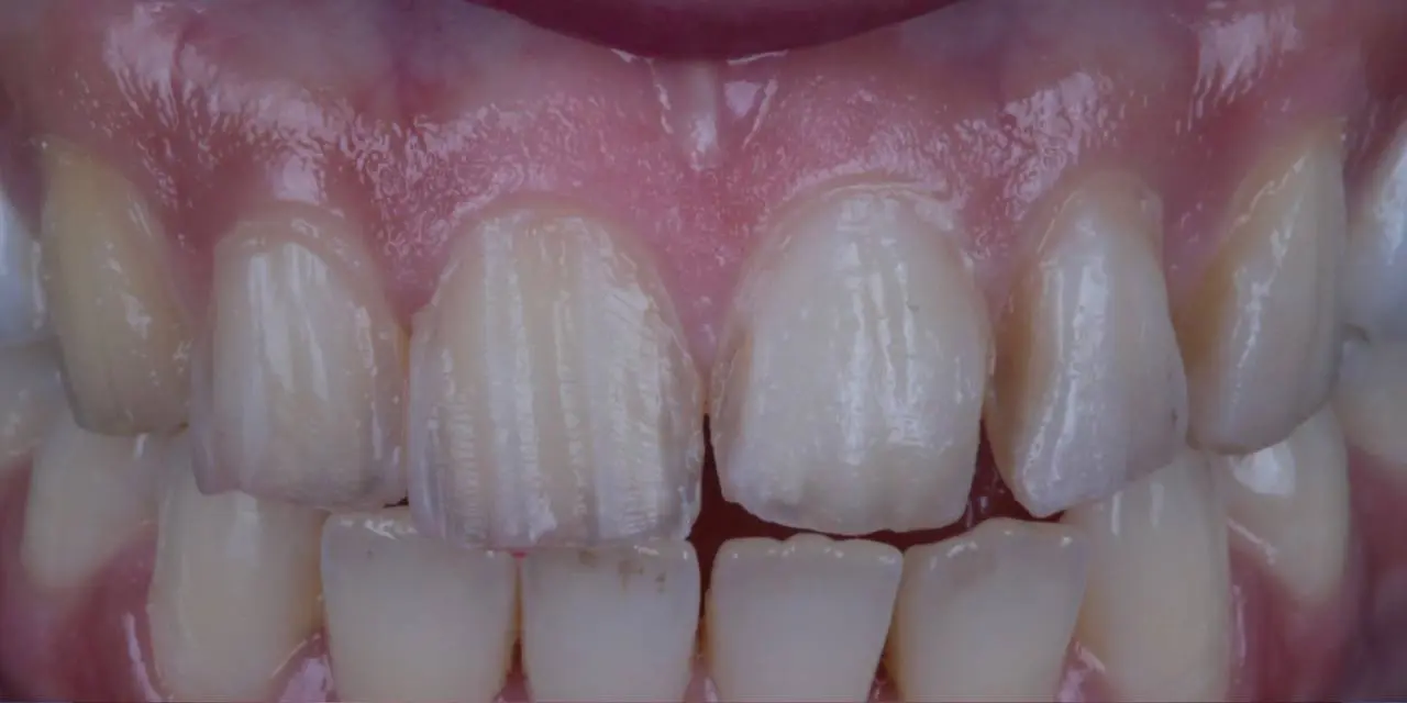 Before Image