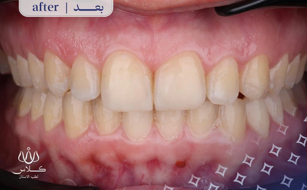 After Image