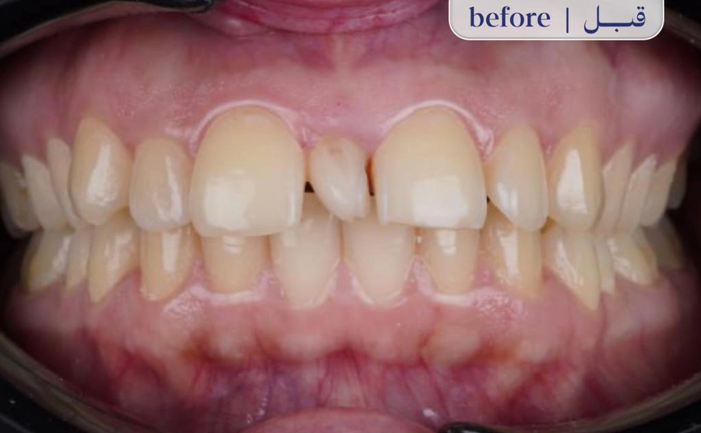 Before Image