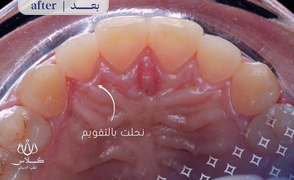 After Image