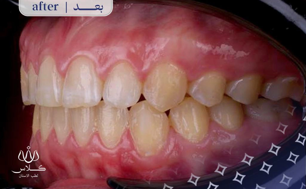 After Image