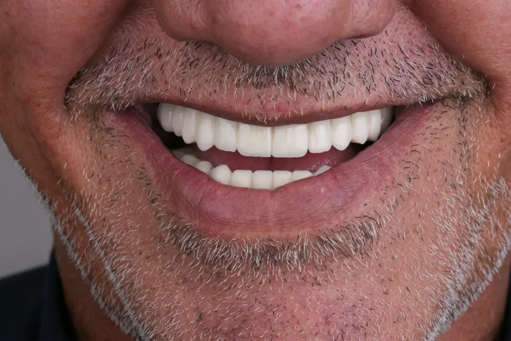 dr-sajad-1-after.webp