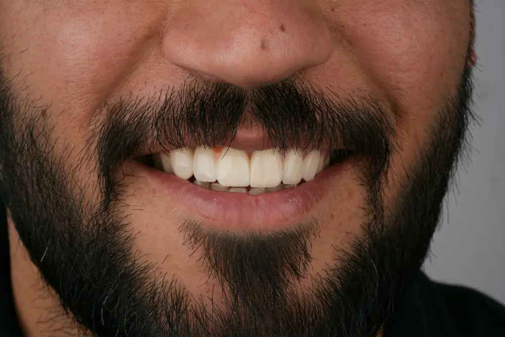 dr-sajad-2-after.webp