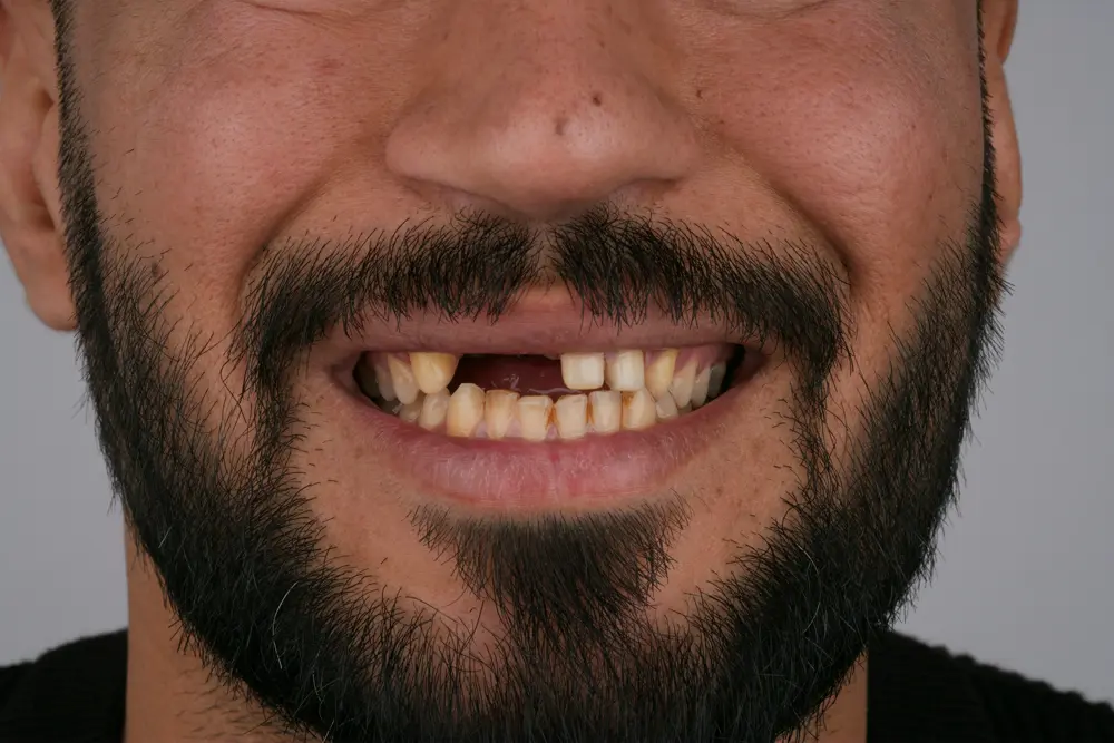Before Image