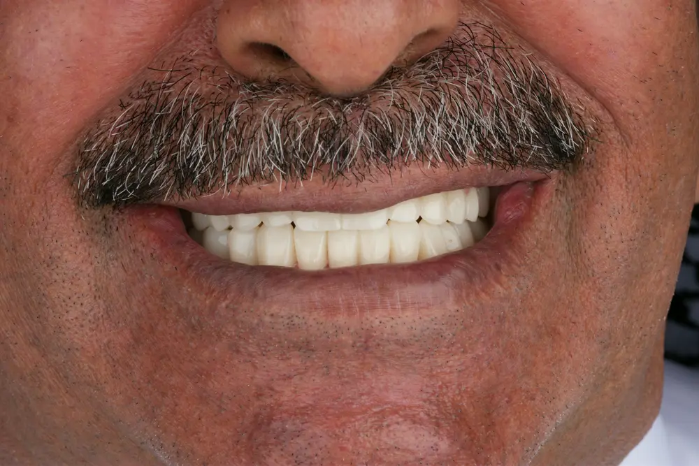dr-sajad-5-after.webp