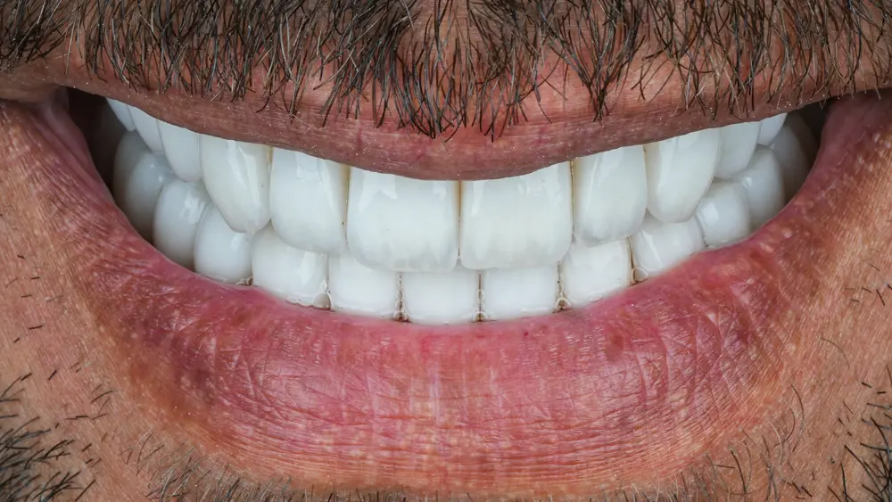 dr-saleh-1-after.webp