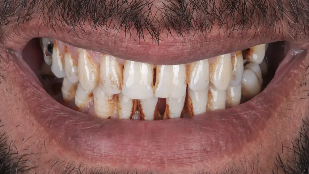 Before Image