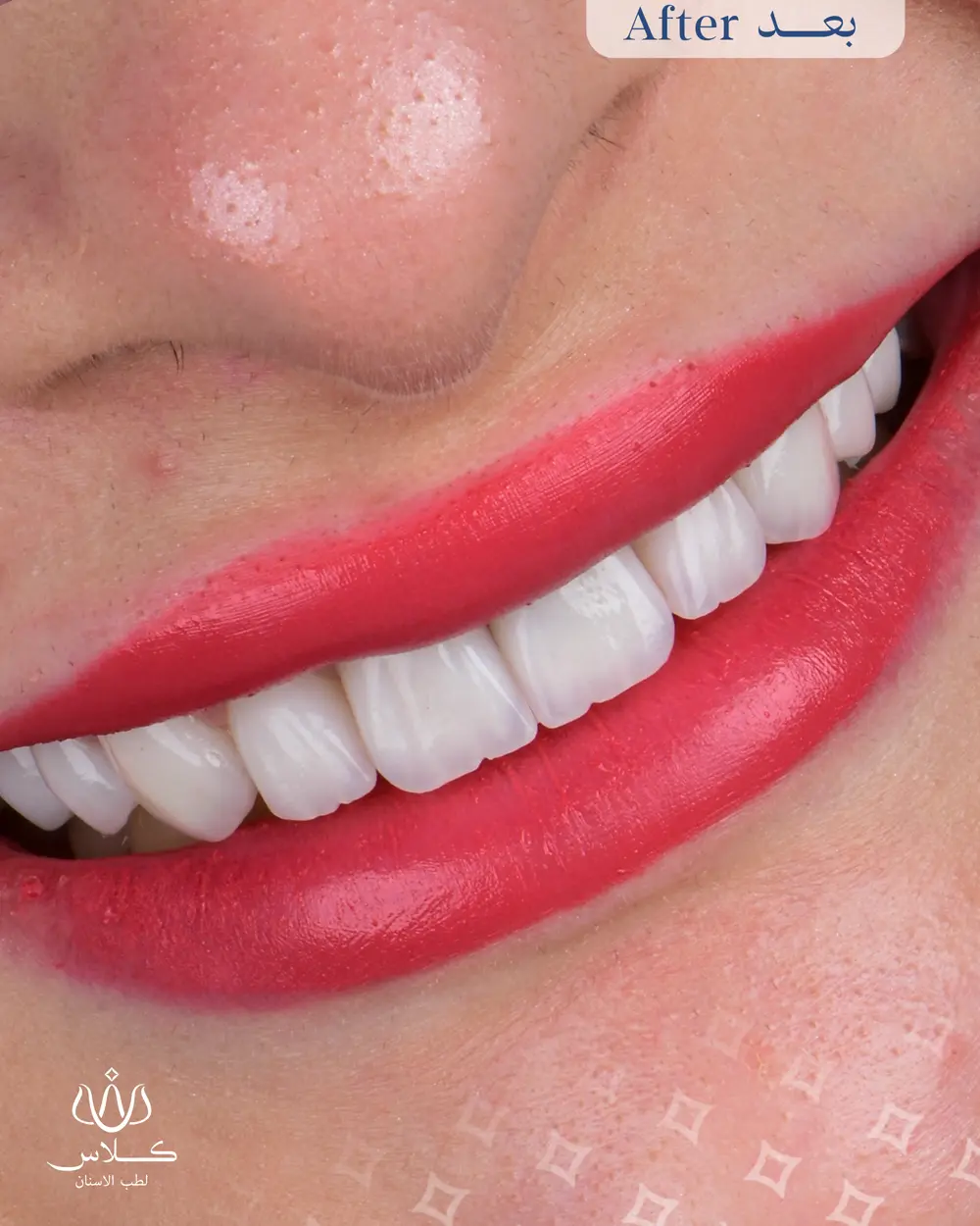 dr-saleh-10-after.webp