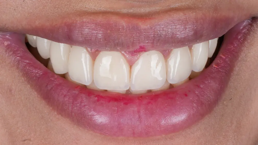 dr-saleh-11-after.webp