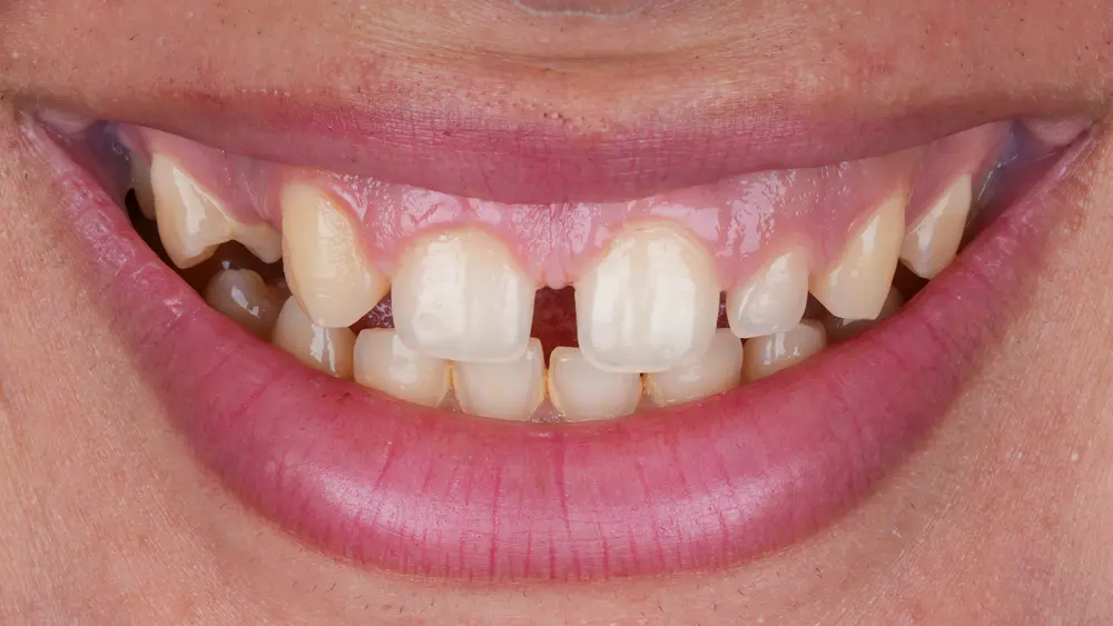 Before Image
