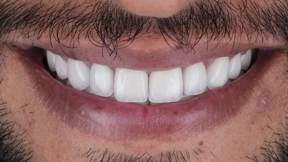 dr-saleh-12-after.webp