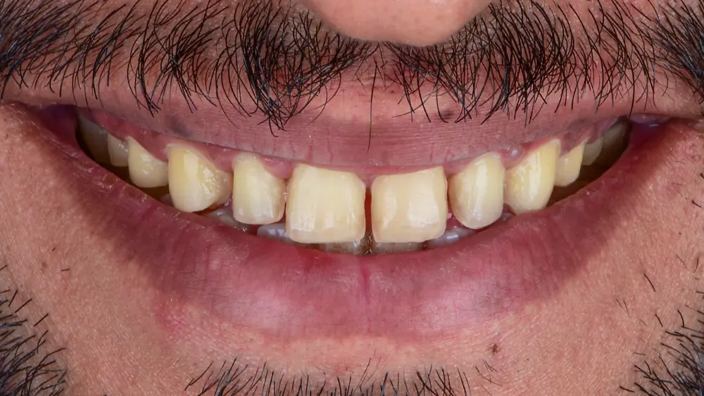 Before Image