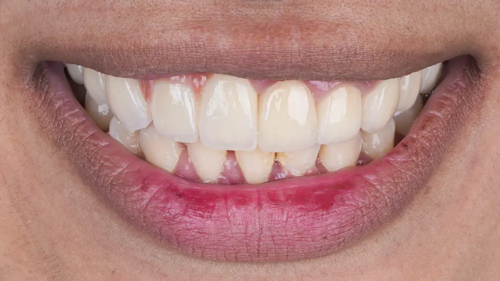 dr-saleh-13-after.webp