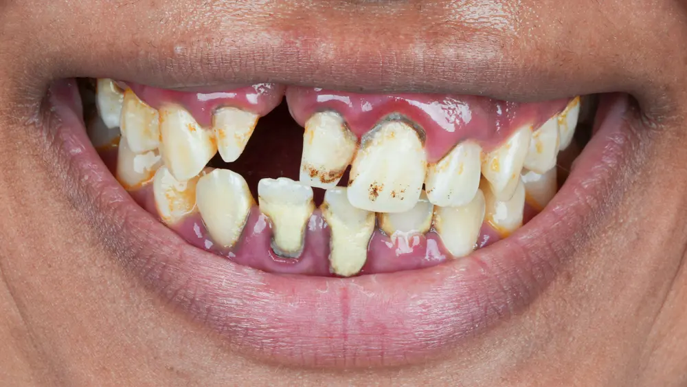 Before Image