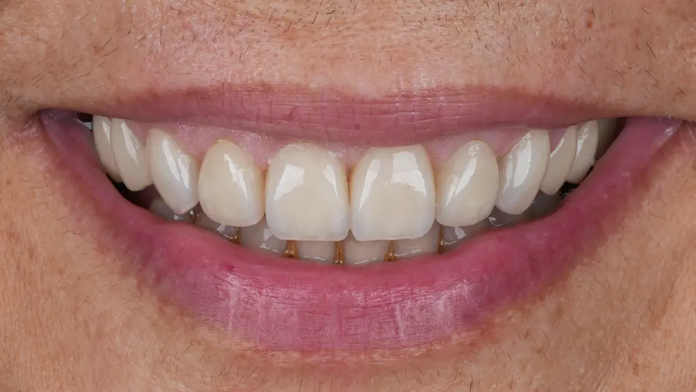 dr-saleh-14-after.webp