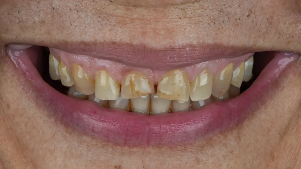 Before Image