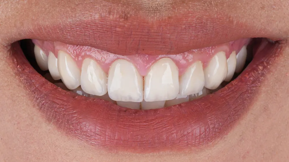 dr-saleh-15-after.webp