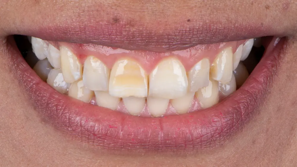 Before Image