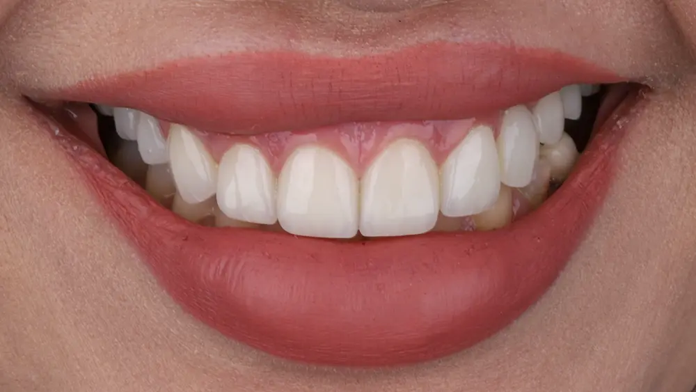 dr-saleh-16-after.webp
