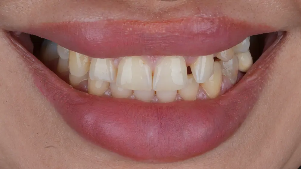 Before Image