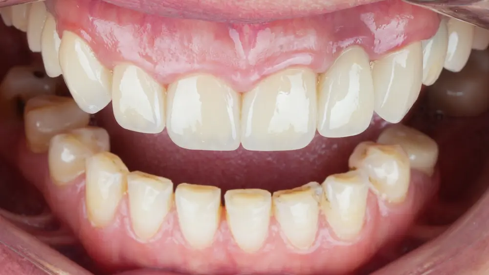 dr-saleh-17-after.webp