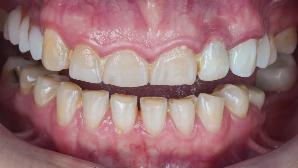 Before Image
