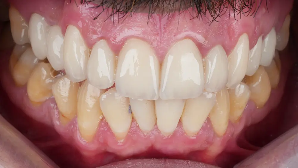 dr-saleh-18-after.webp
