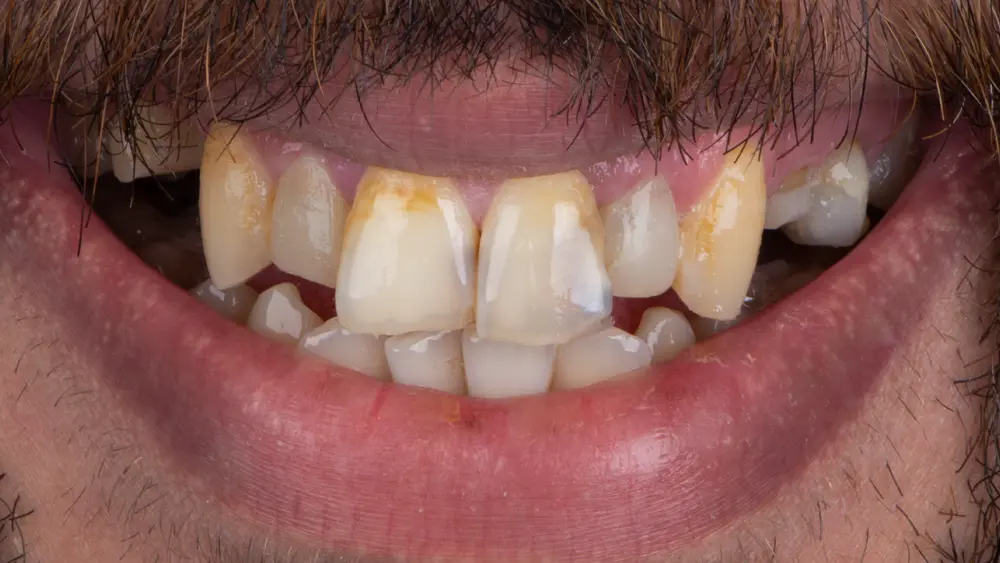 Before Image