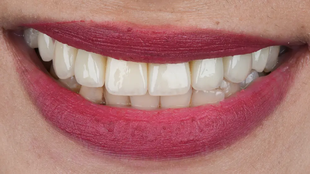 dr-saleh-19-after.webp