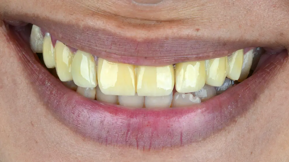 Before Image