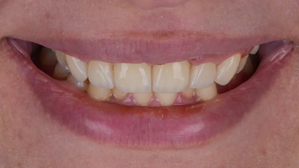 dr-saleh-20-after.webp