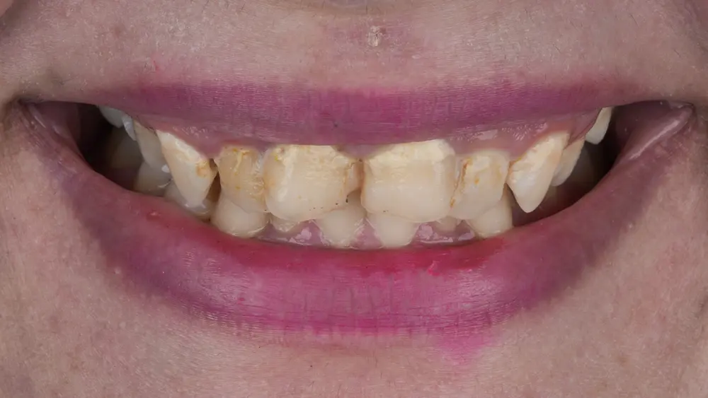Before Image