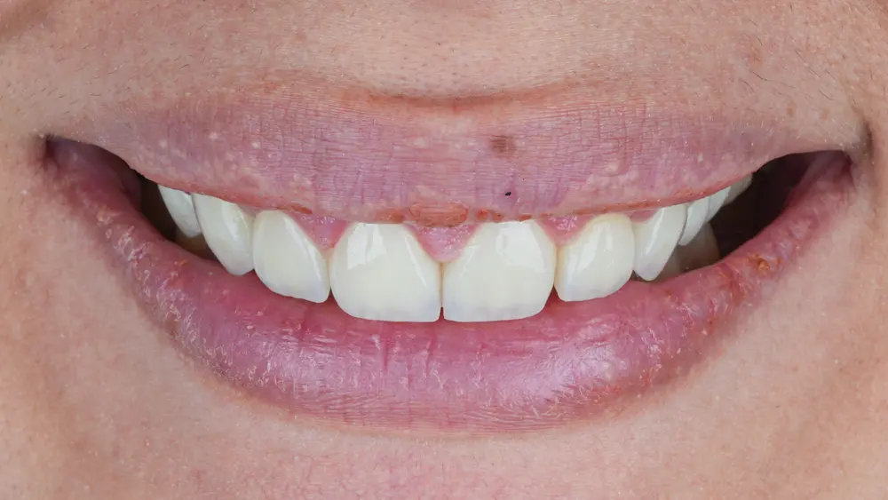 dr-saleh-21-after.webp