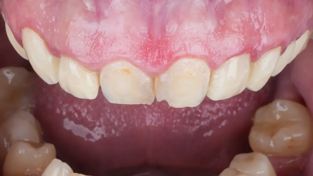 Before Image