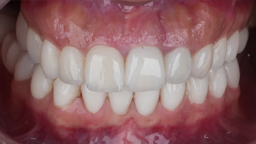 dr-saleh-22-after.webp