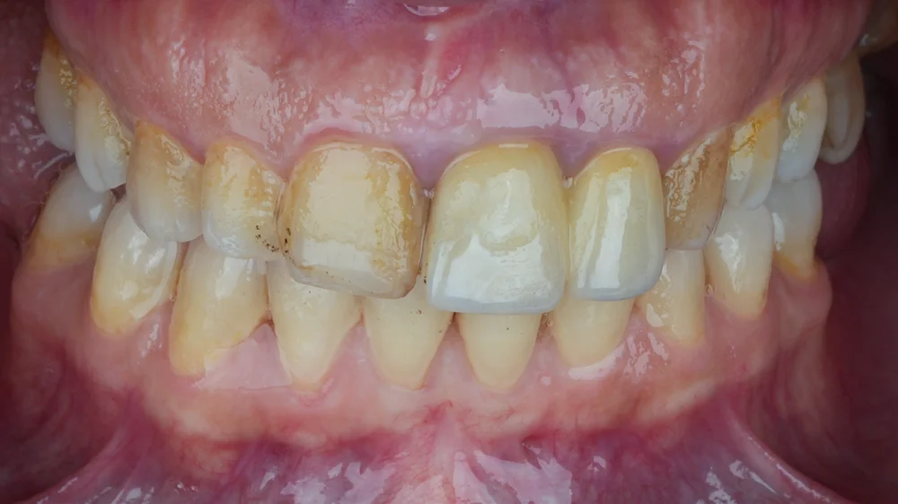 Before Image
