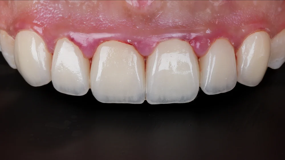 dr-saleh-23-after.webp