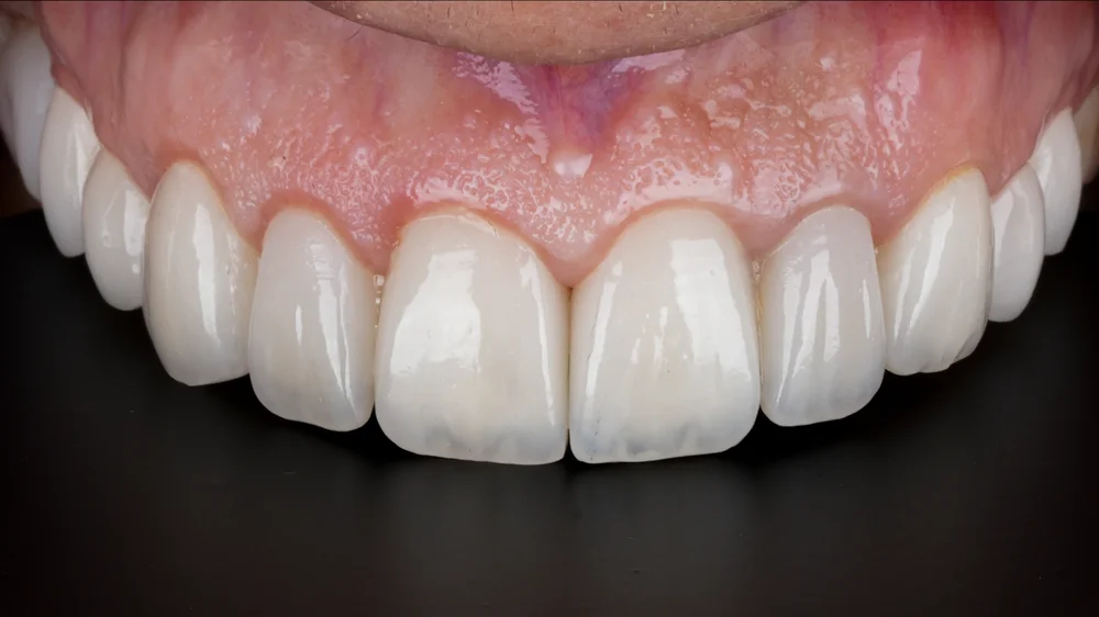 dr-saleh-24-after.webp