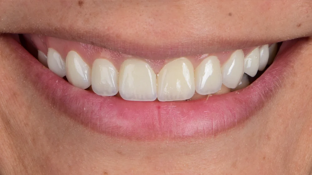 dr-saleh-25-after.webp