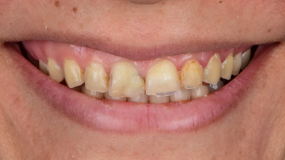 Before Image