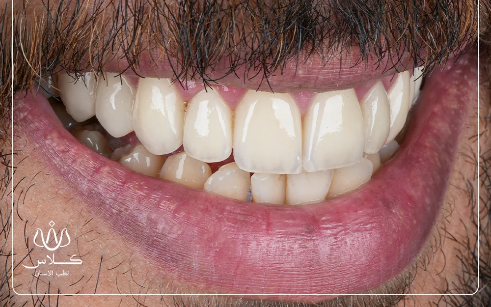 dr-saleh-26-after.webp