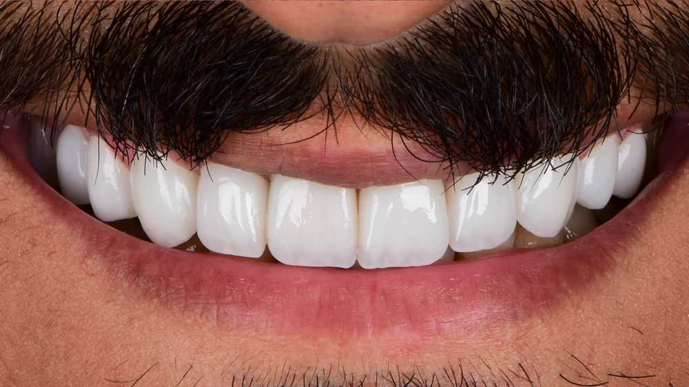 dr-saleh-27-after.webp