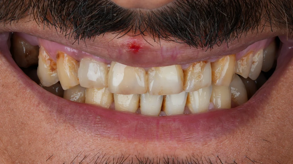 Before Image