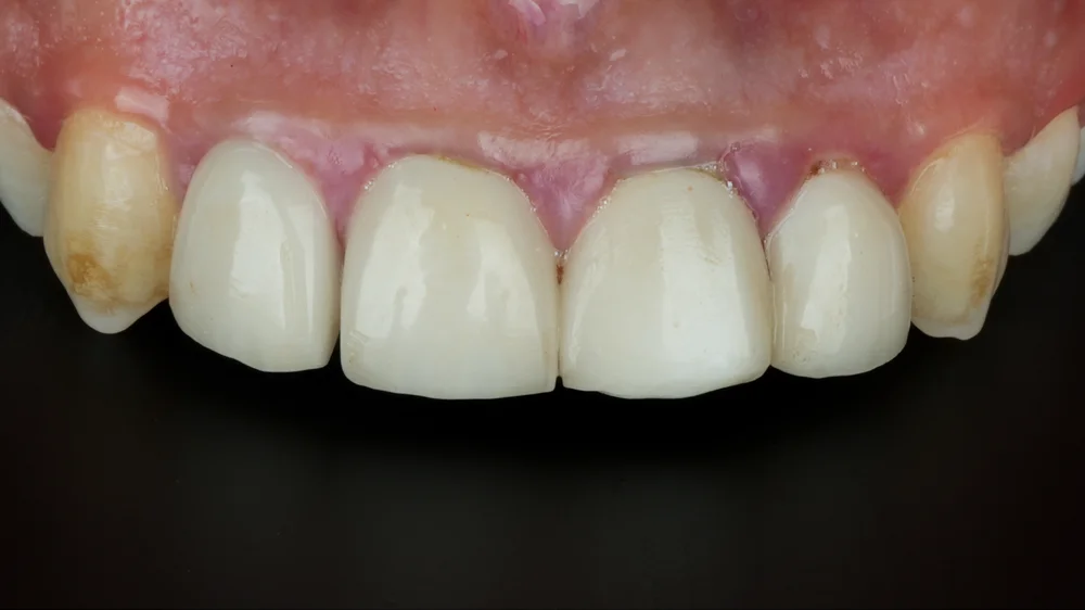 Before Image