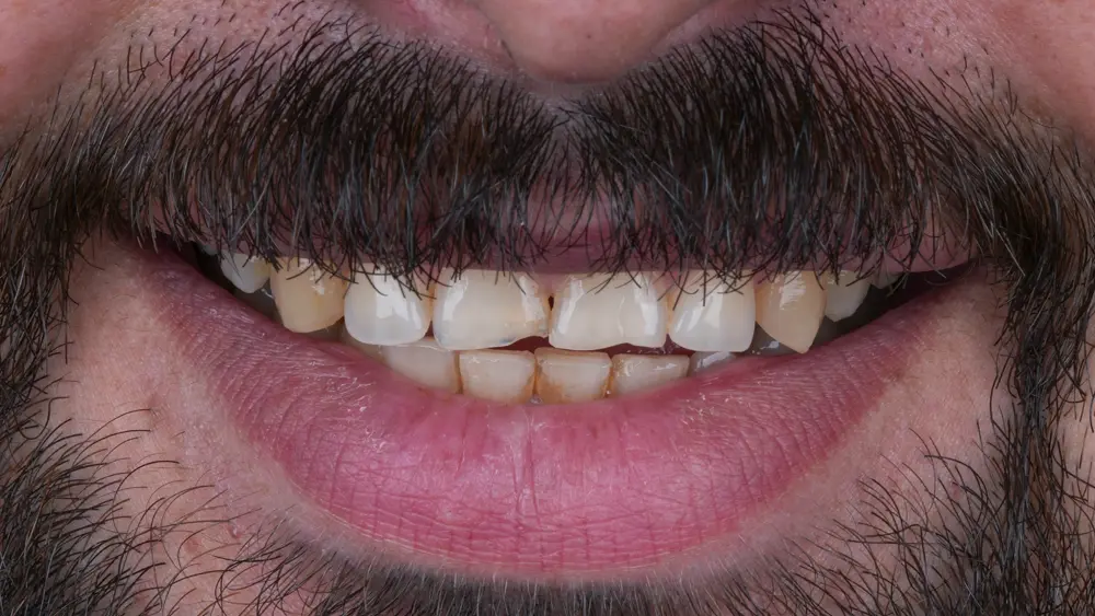 Before Image
