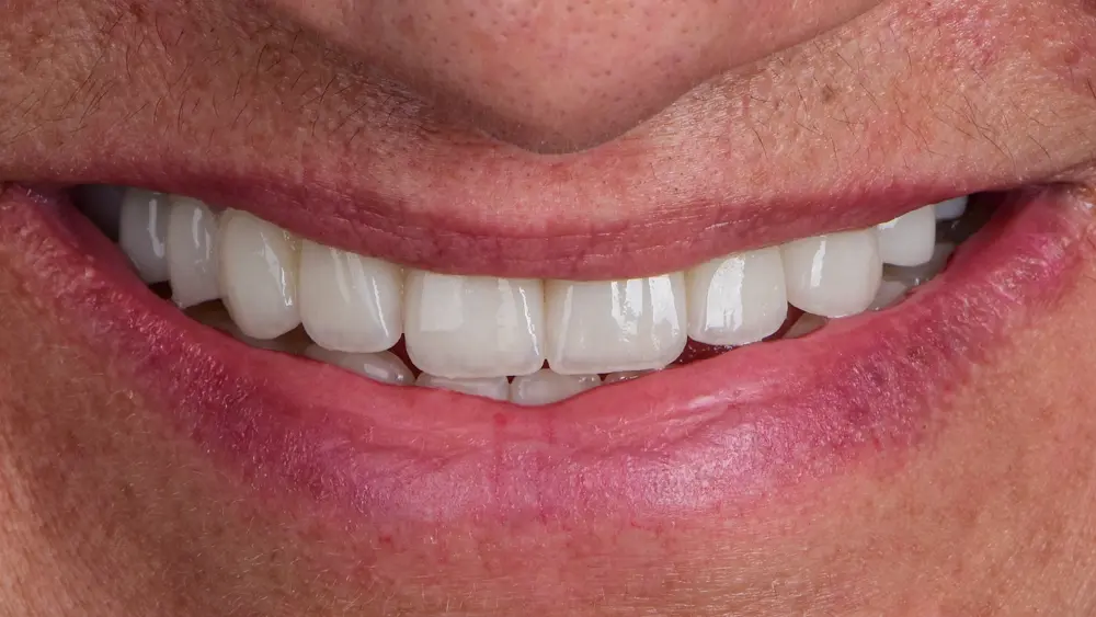 dr-saleh-4-after.webp