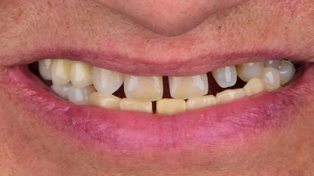 Before Image