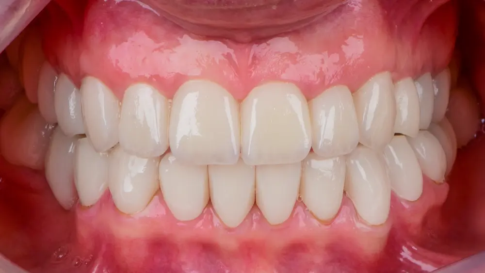 dr-saleh-5-after.webp