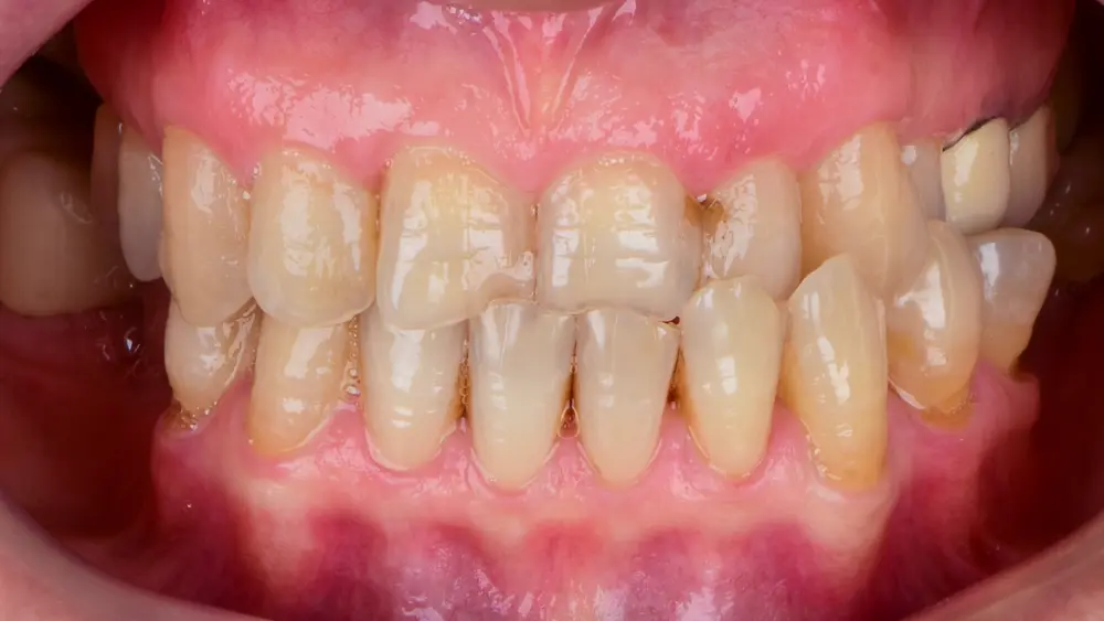 Before Image